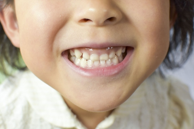 綺麗な歯並びの子供